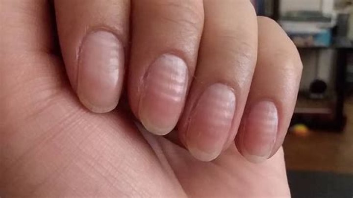 Are teeth stronger than fingernails?