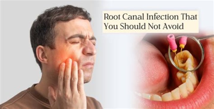 Can a dentist do a root canal on an infected tooth?