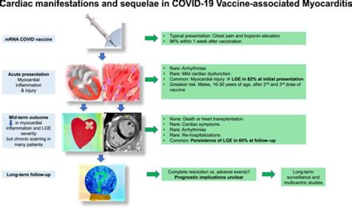 Can COVID-19 vaccine cause pericarditis?