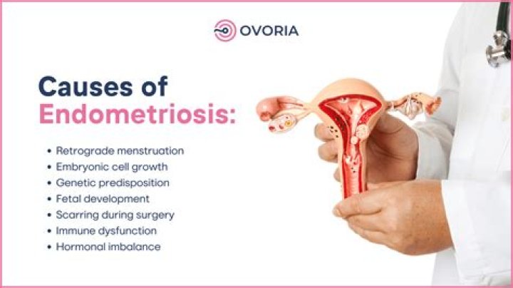 Can you have endometriosis for years and not know it?