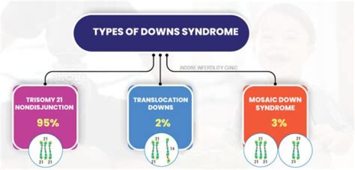 Does Down syndrome run in the family?