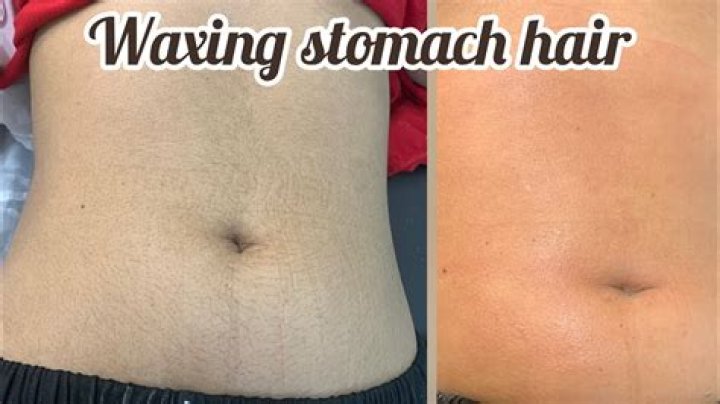 How can I permanently remove hair from my stomach naturally?