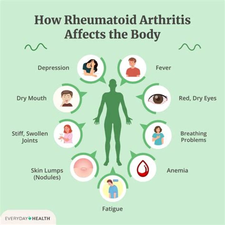 How far should you walk if you have arthritis?