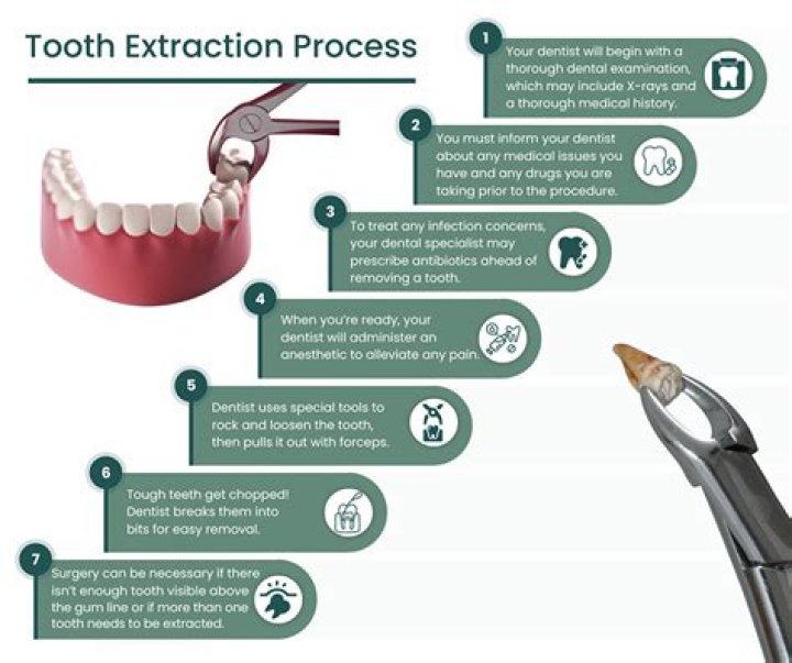 How long will my mouth hurt after tooth extraction?