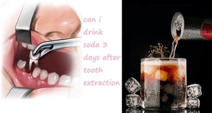 【How-to】Can i drink sprite after tooth extraction
