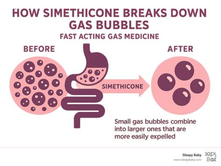 【How-to】How fast does simethicone work