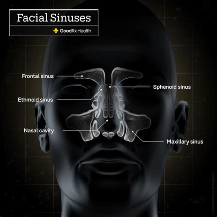 【How-to】How to drain sphenoid sinus at home