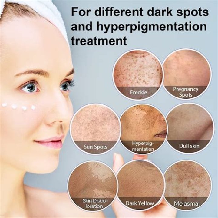 【How-to】How to get rid of white sunspots