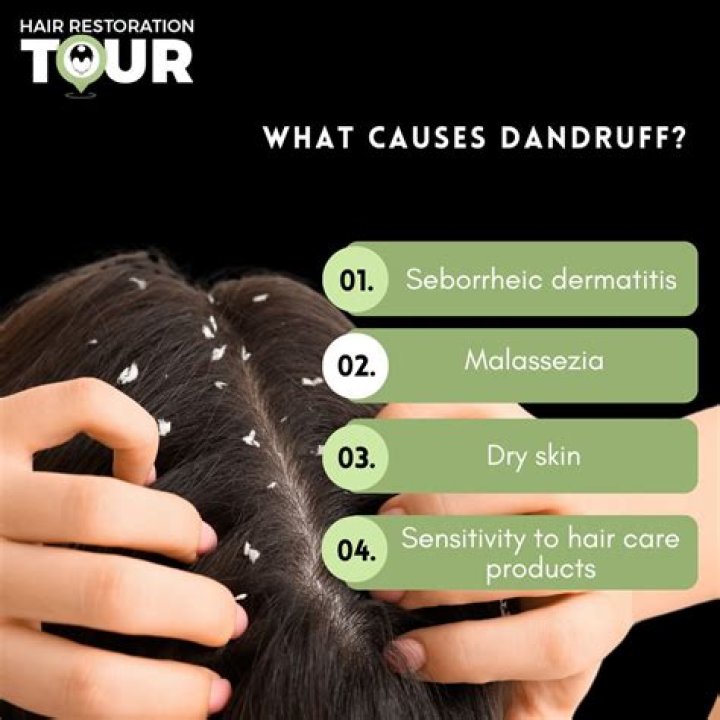 【How-to】What can cause dandruff - Howto.org