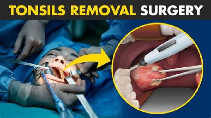 【How-to】What kind of doctor removes moles