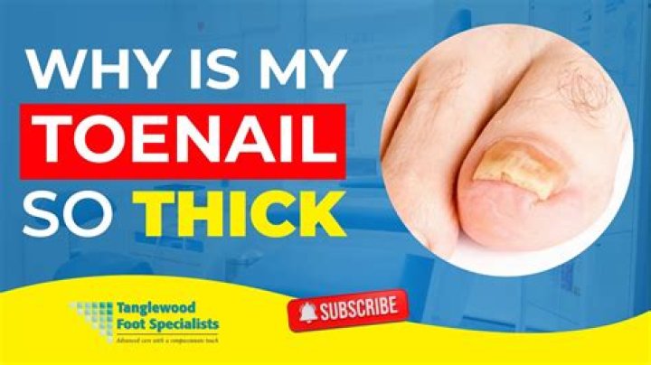 【How-to】Why does my little toenail not grow