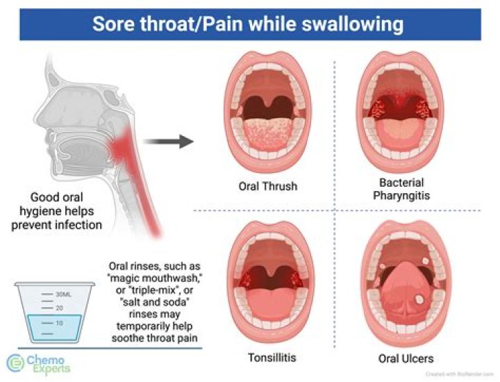 【How-to】Why does my throat hurt when i yawn