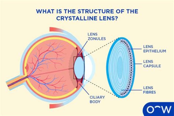 Is the lens of truth required?