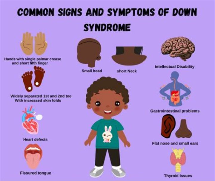 What are the behavioral symptoms of Down syndrome?