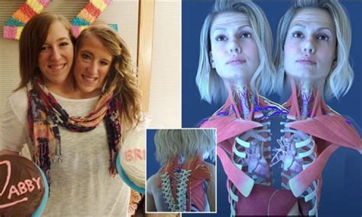 What does Abby and Brittany look like now?
