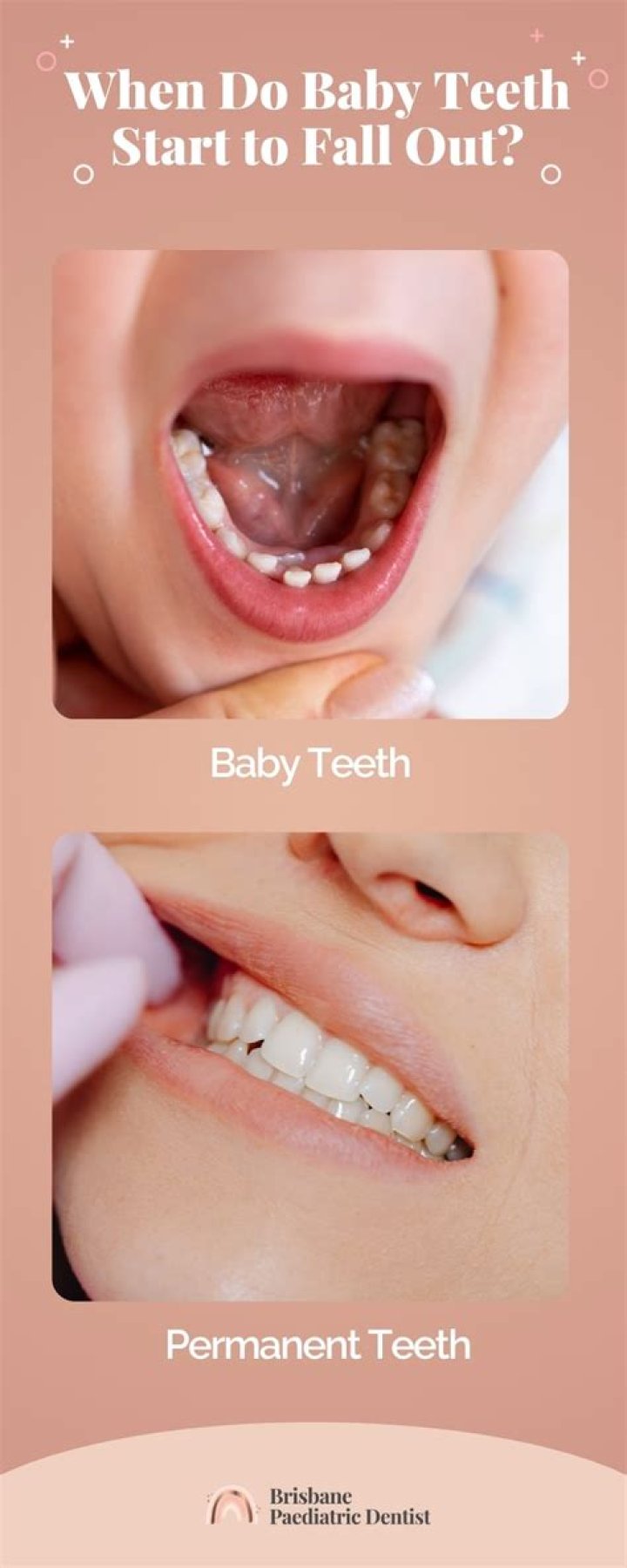 When does the silver tooth fall out?