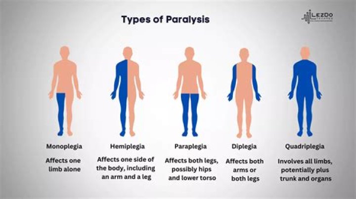 Why do they paralyze you during surgery?
